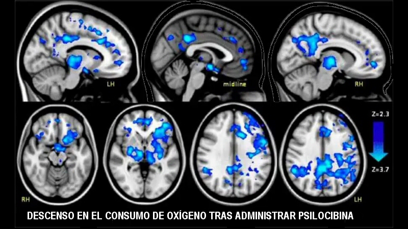 fMRI tras Psilocibina