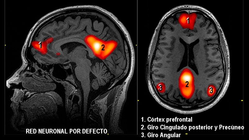 Red Neuronal por defecto